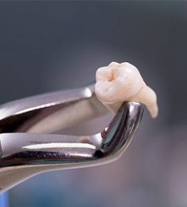 Biological Tooth Extractions
