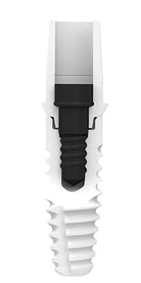 zeramex xt screw retained connection