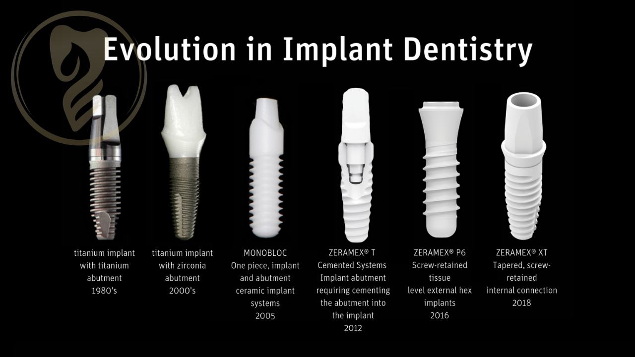 Evolution in Implant Dentistry.jpg