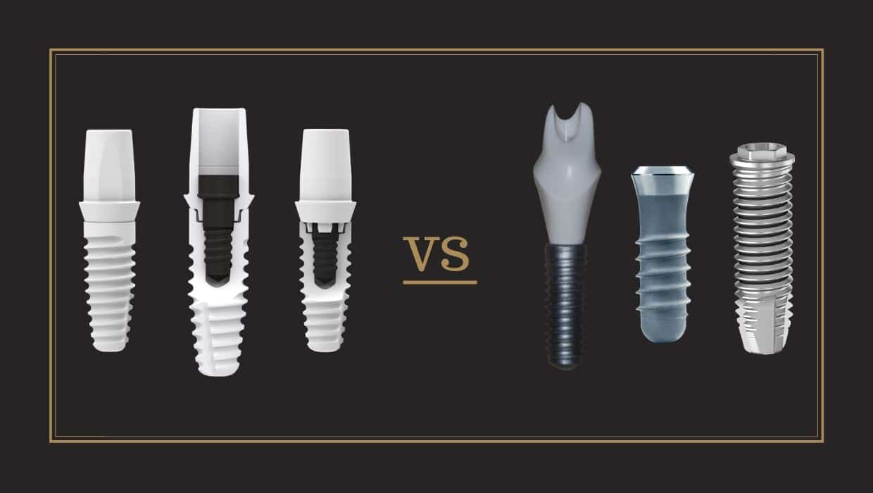 ZERAMEX Ceramic Implants versus Titanium Implants