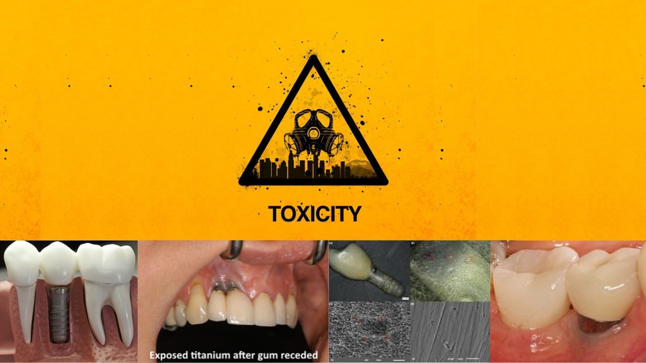 Titanium Toxicity
