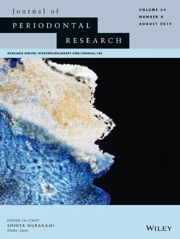 Macrophage polarization in aseptic bone resorption around dental implants induced by Ti particles in a murine model.