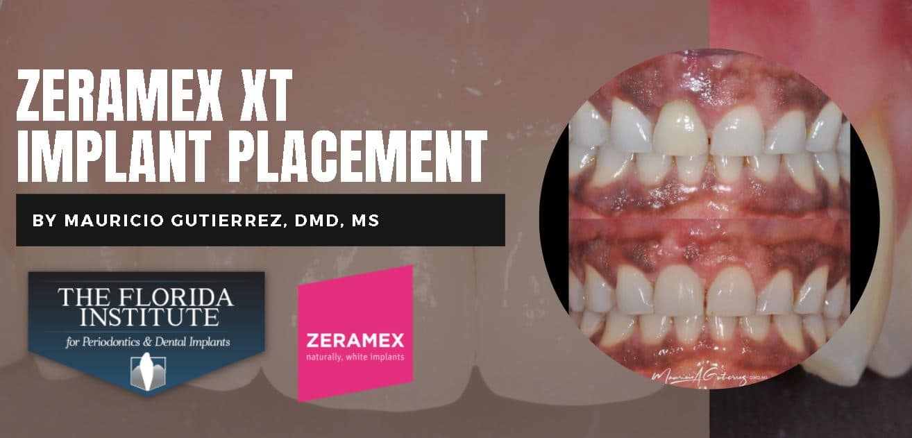 Case by Dr. Mauricio Gutierrez