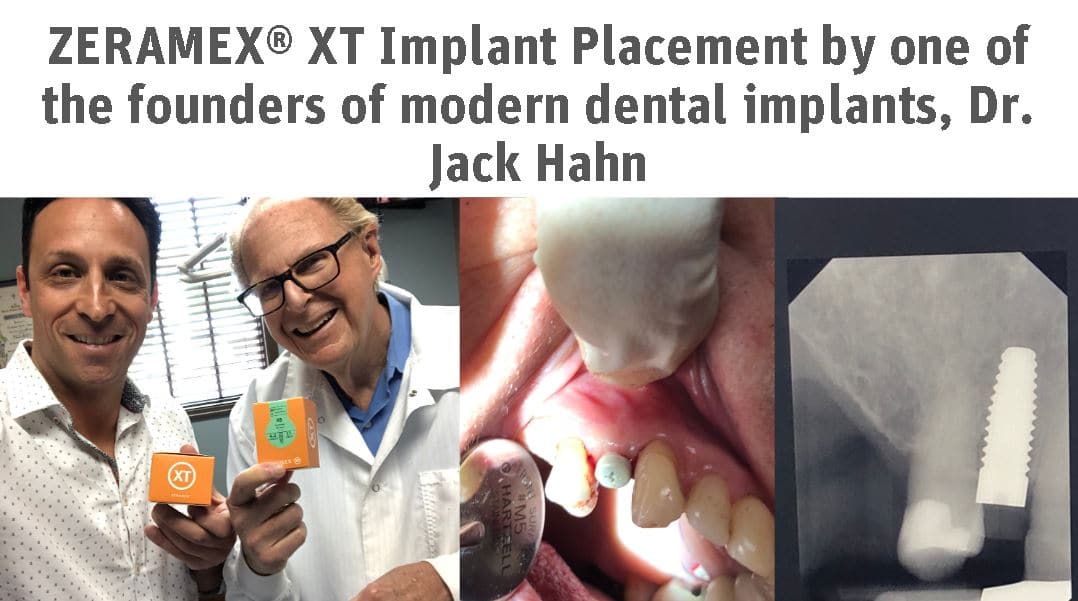ZERAMEX® XT Implant Placement by one of the founders of modern dental implants, Dr. Jack Hahn