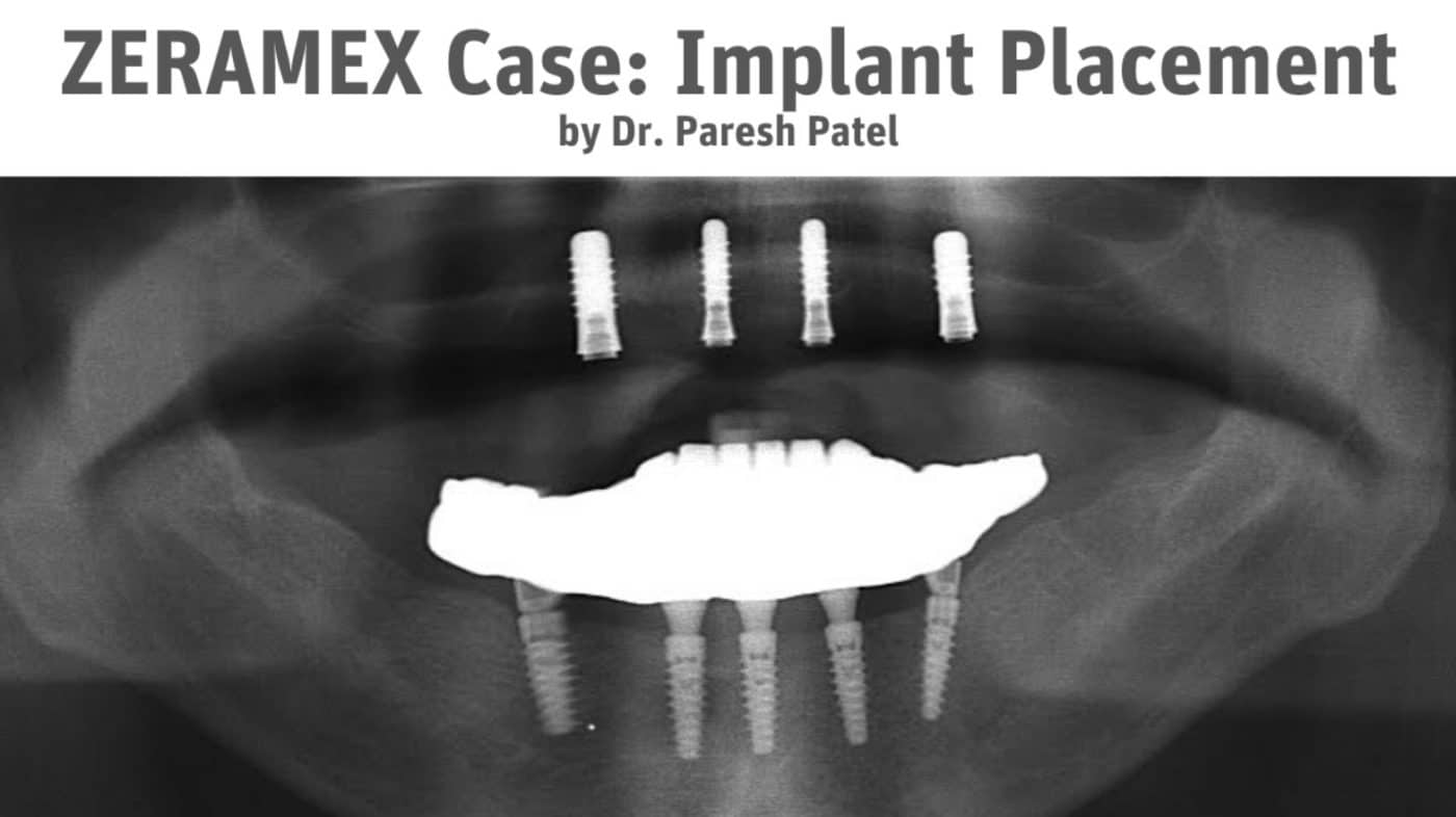 Dr. Paresh Patel’s first ZERAMEX Case