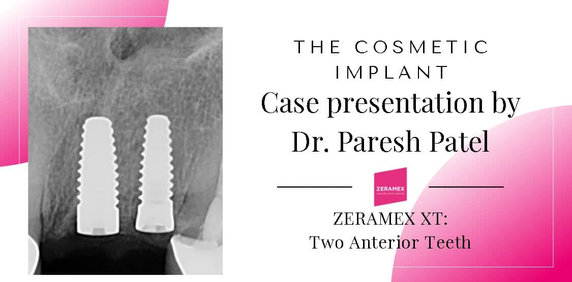 The cosmetic implant by dr paresh patel