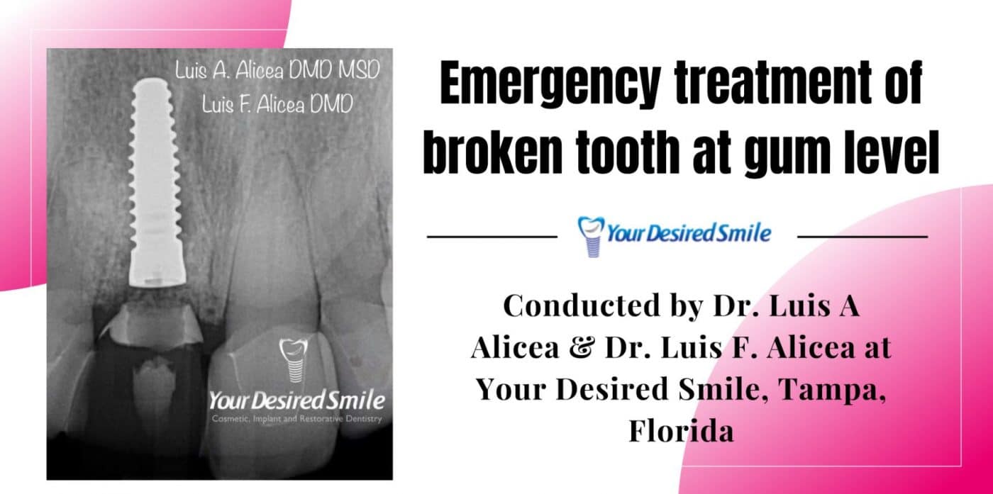 Emergency Treatment banner your desired smile
