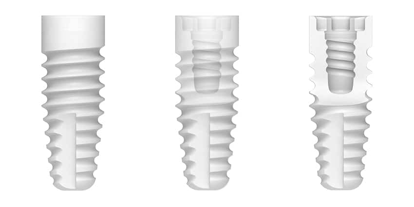 zeramex_xt_implant_cut_850x425px