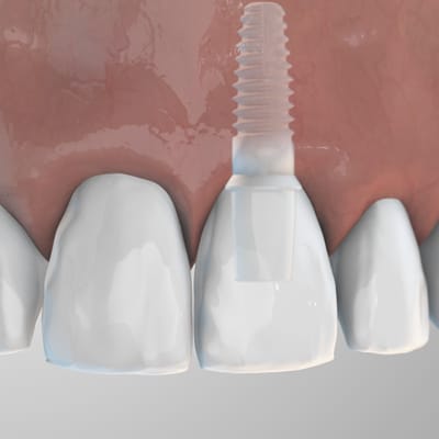 zeramex_xt_solution_front_400x400px