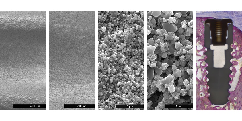 zeramex_xt_zerafil_surfaces_850x425px