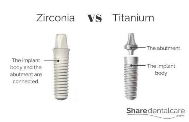 Zirconia Vs Titanium Implants: The Differences - Zeramex USA