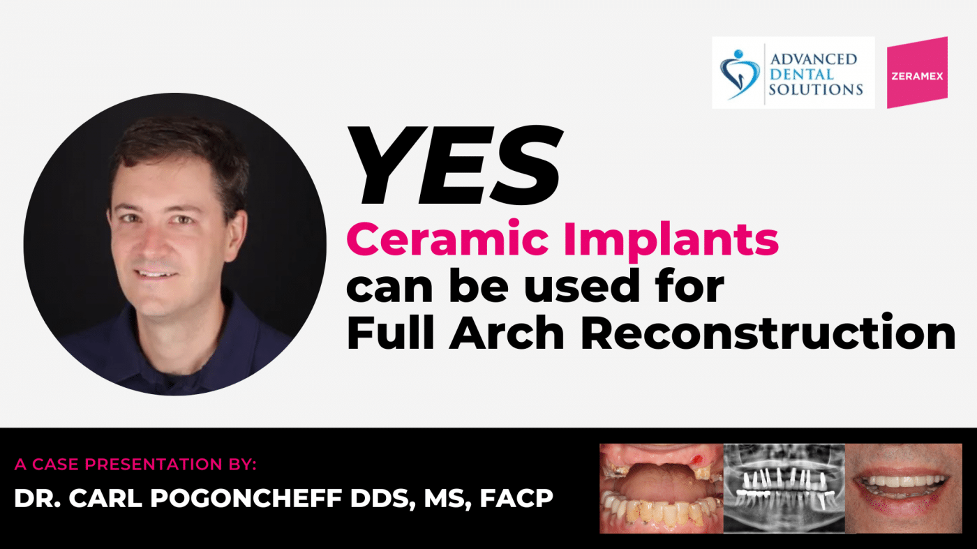 zeramex-Yes Ceramic Implants can be used for Full Arch Reconstruction_dr carl pogoncheff_banner.png