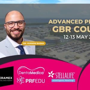 Advanced PRF GBR Course May 2023 Zeramex