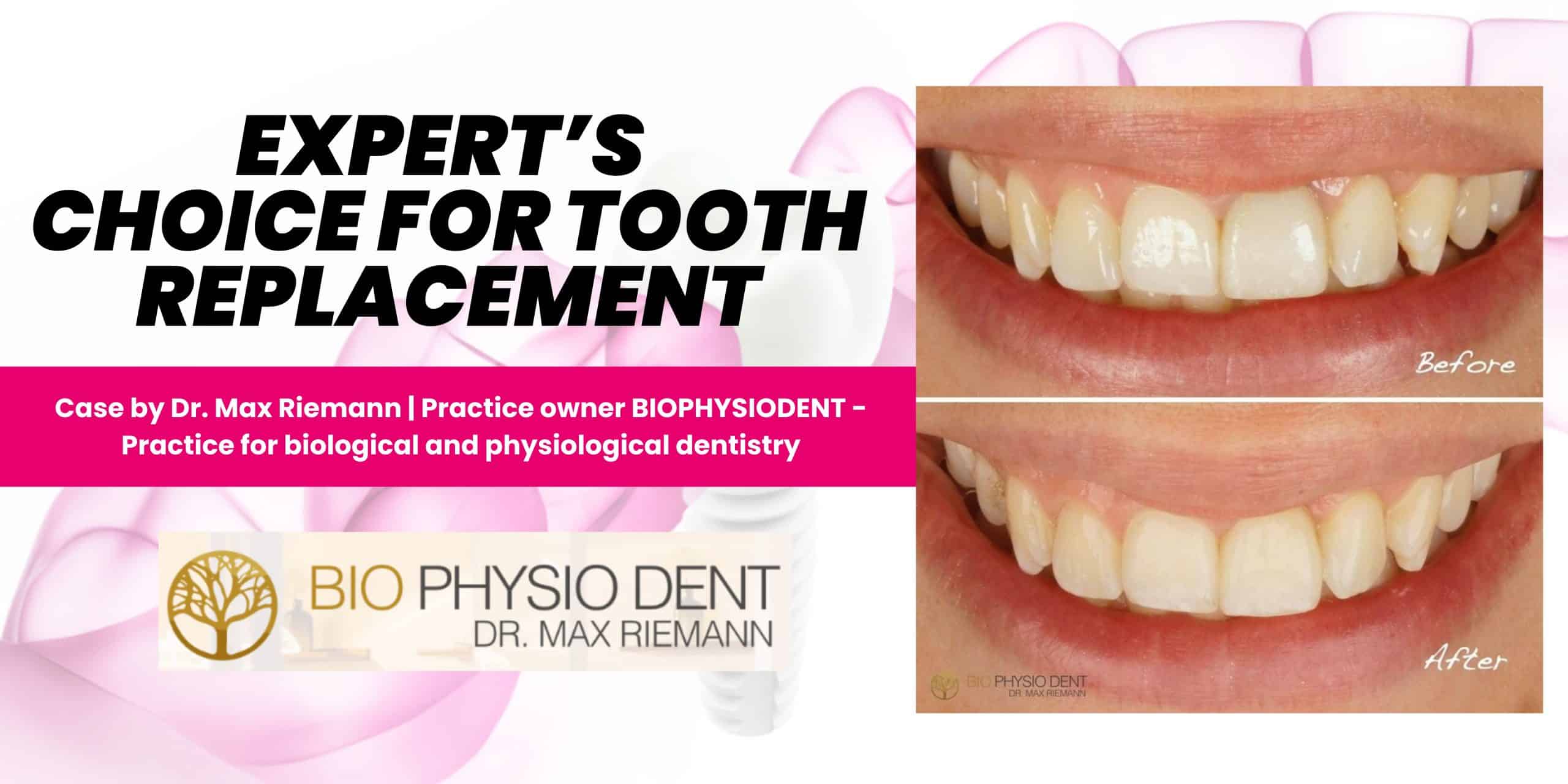 Dr.-Max-Riemann_Case-