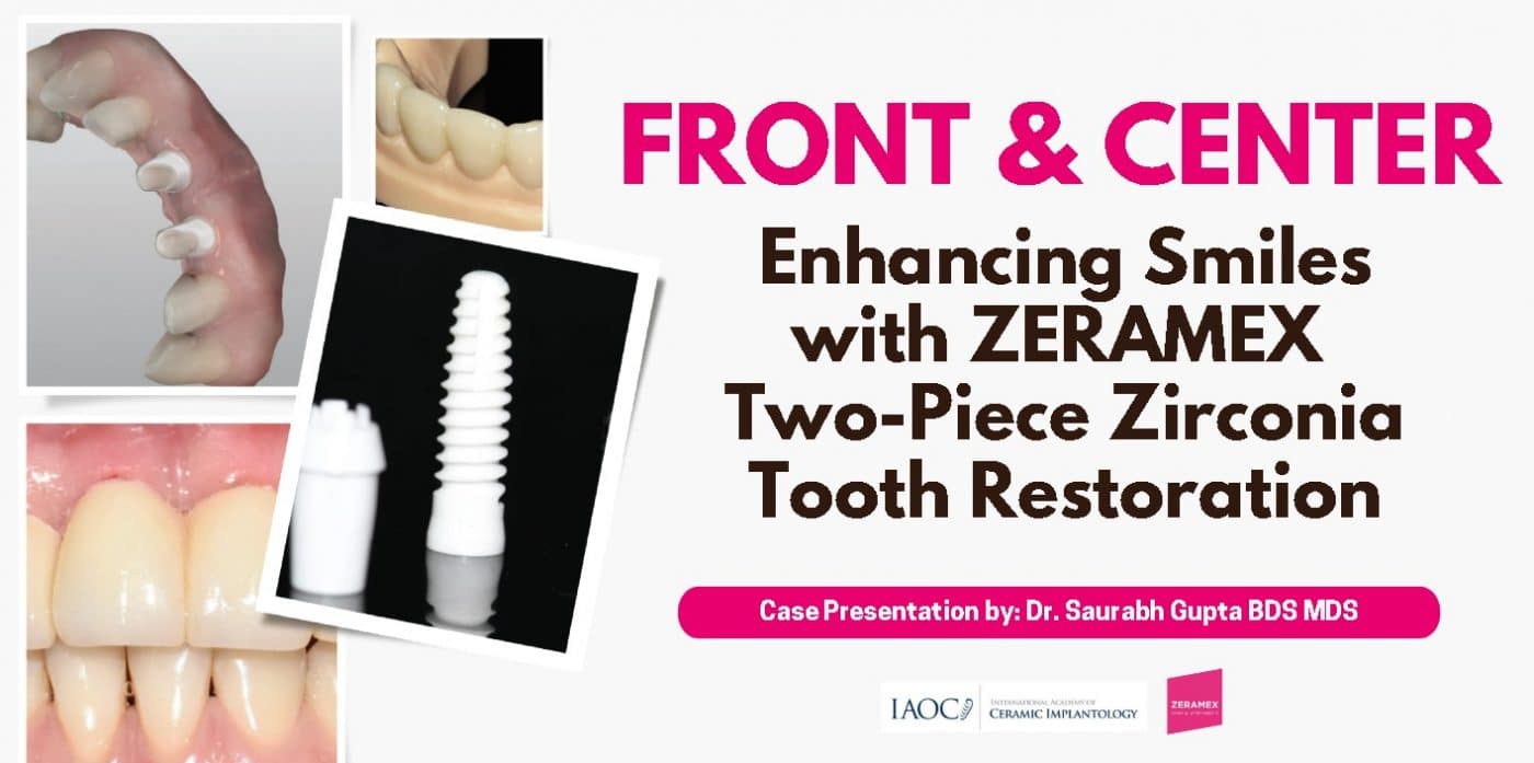 Front and Center: Enhancing Smiles with ZERAMEX Two-Piece Zirconia